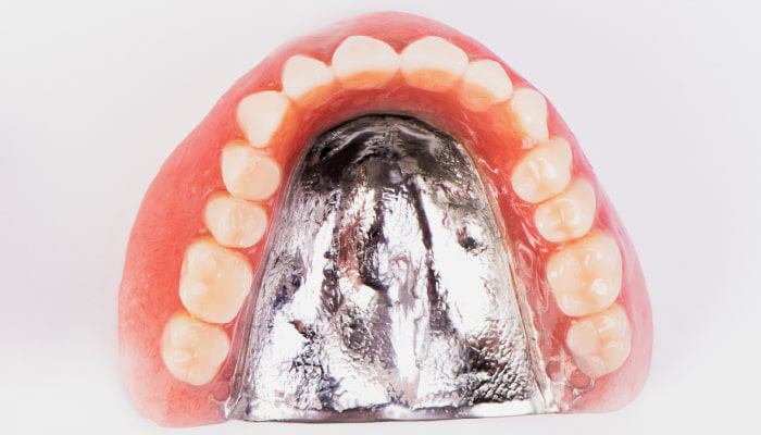 金属床義歯（精密デンチャー）