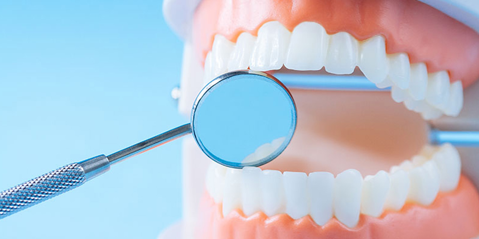 歯周病の検査・治療方法