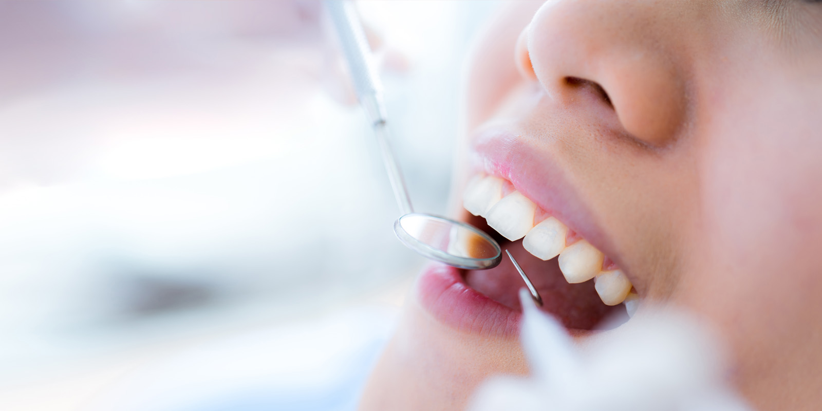 予防歯科／定期検診・歯のクリーニング